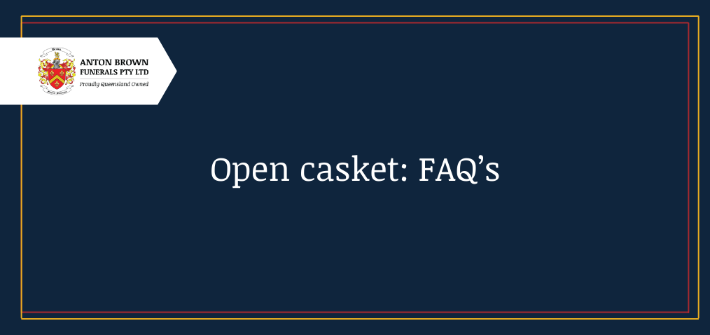 Open Casket: FAQS